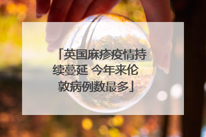 英国麻疹疫情持续蔓延 今年来伦敦病例数最多